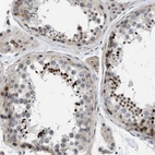 Immunohistochemical staining of human testis shows strong nuclear positivity in a subset of cells in seminiferous ducts.