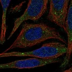 Anti-PATL1 Antibody