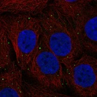 Anti-CTNS Antibody