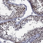 Anti-EHMT1 Antibody