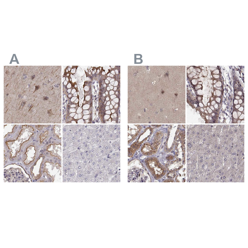 Anti-PLEKHG3 Antibody