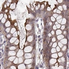Immunohistochemical staining of human colon using Anti-PLEKHG3 antibody HPA074734.