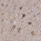 Immunohistochemical staining of human cerebral cortex using Anti-PLEKHG3 antibody HPA074734.