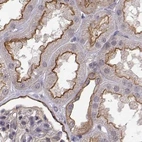 Immunohistochemical staining of human kidney using Anti-PLEKHG3 antibody HPA074734.