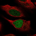 Anti-KMT2C Antibody