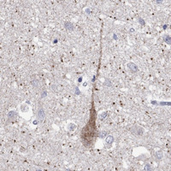 Anti-MC3R Antibody