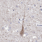 Anti-MC3R Antibody