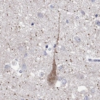Anti-MC3R Antibody