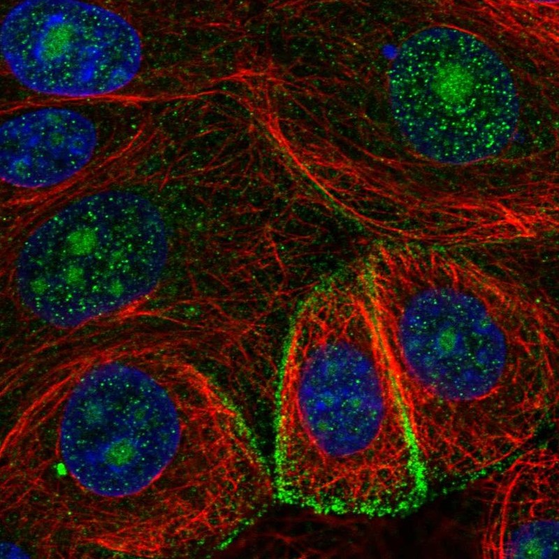 Anti-GDE1 Antibody
