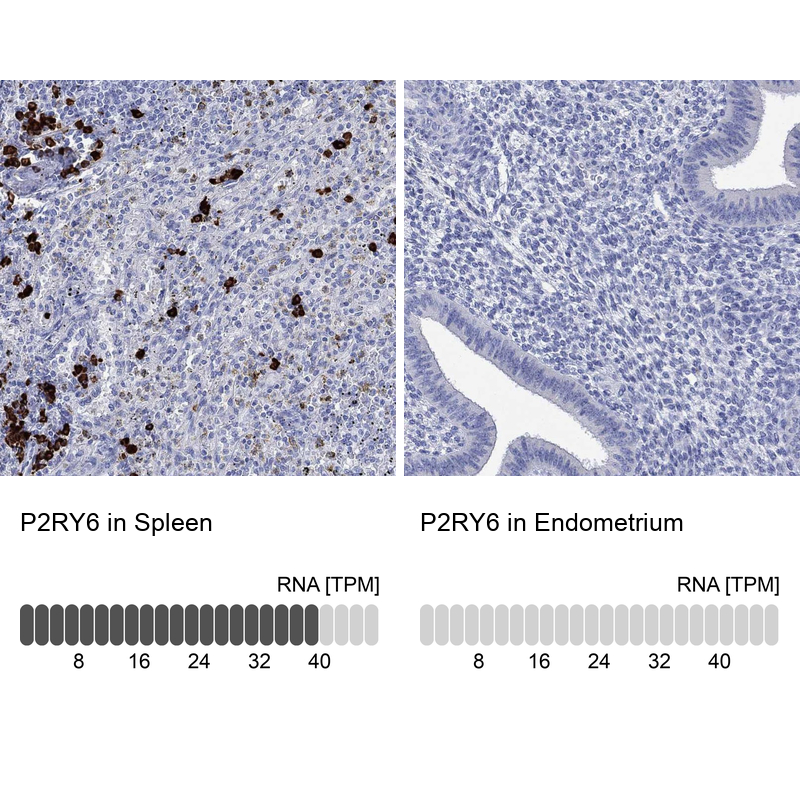 Anti-P2RY6 Antibody