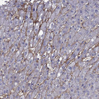 Anti-AQP9 Antibody