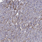 Immunohistochemical staining of human liver shows strong membranous positivity in hepatocytes.