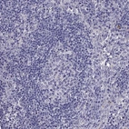 Immunohistochemical staining of human lymph node shows no positivity in germinal center cells as expected.