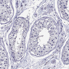 Immunohistochemical staining of human testis shows no positivity in cells in seminiferous ducts as expected.