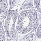 Immunohistochemical staining of human testis shows no positivity in cells in seminiferous ducts as expected.
