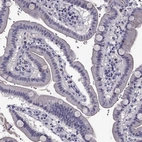 Immunohistochemical staining of human duodenum shows no positivity in glandular cells as expected.