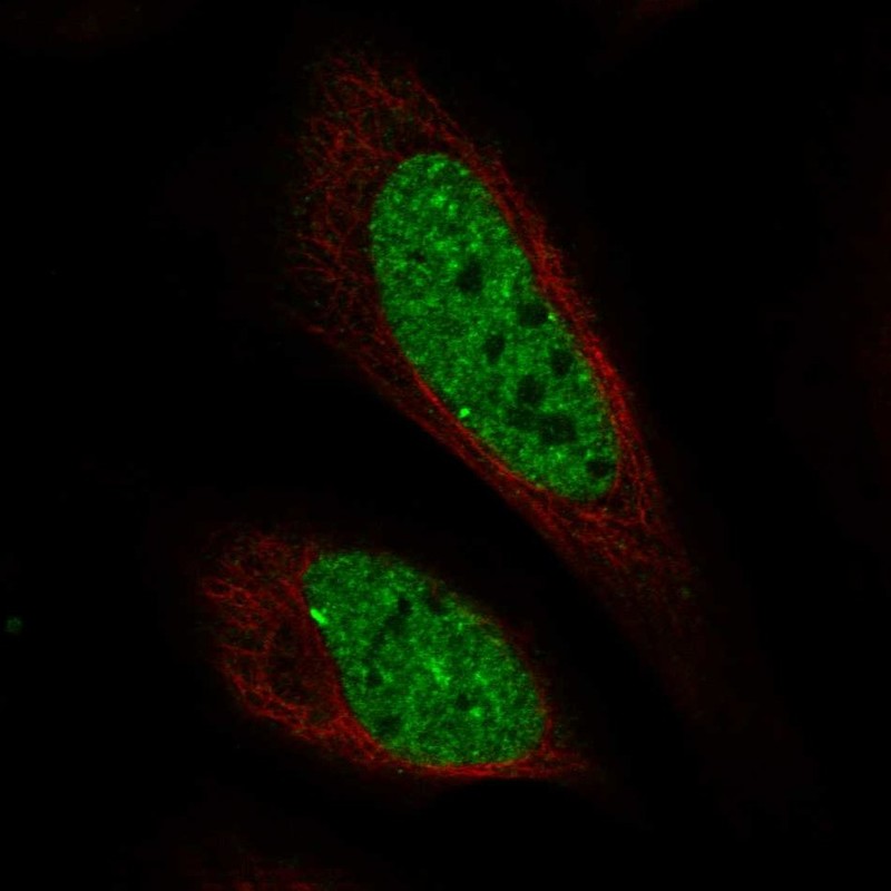 Anti-C11orf71 Antibody