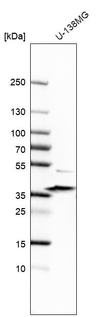 Anti-SGCE Antibody
