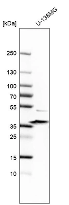 Anti-SGCE Antibody