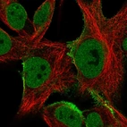 Immunofluorescent staining of human cell line SK-MEL-30 shows localization to nucleoplasm, plasma membrane & vesicles.