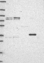 Anti-MT-CYB Antibody