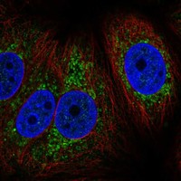 Anti-MT-CYB Antibody