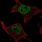 Anti-SMIM19 Antibody