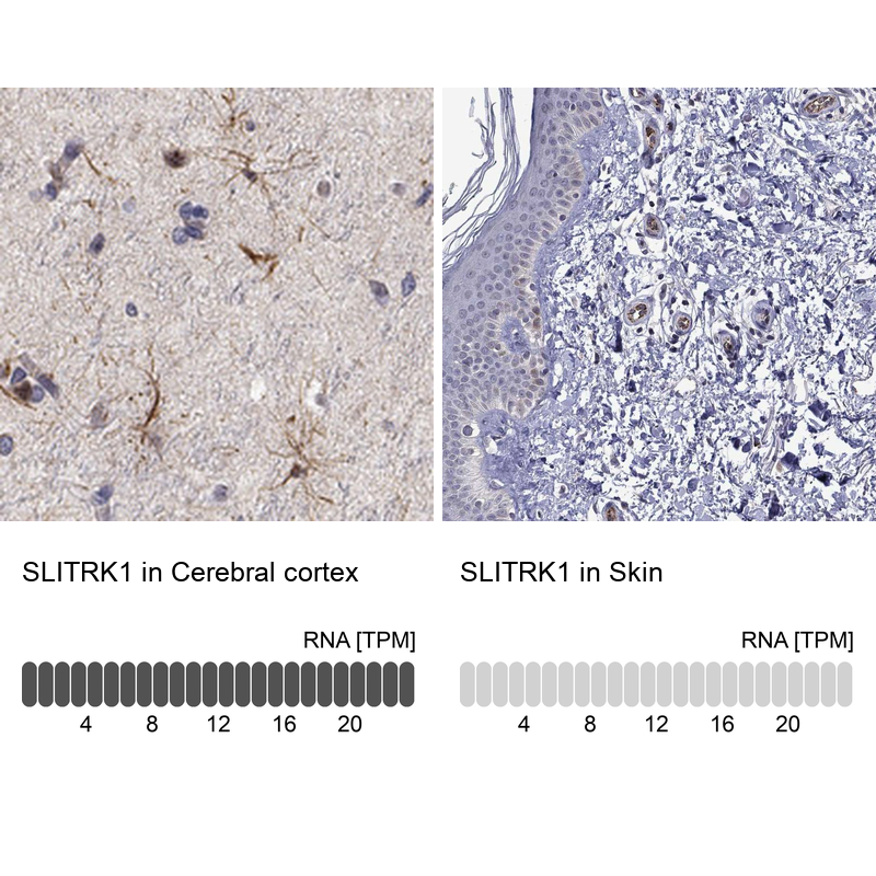 Anti-SLITRK1 Antibody