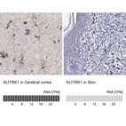 Anti-SLITRK1 Antibody