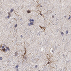 Immunohistochemical staining of human cerebral cortex shows high expression.