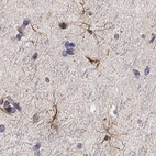 Immunohistochemical staining of human cerebral cortex shows high expression.