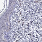 Immunohistochemical staining of human skin shows low expression as expected.