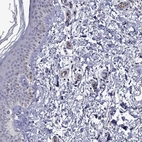 Immunohistochemical staining of human skin shows low expression as expected.
