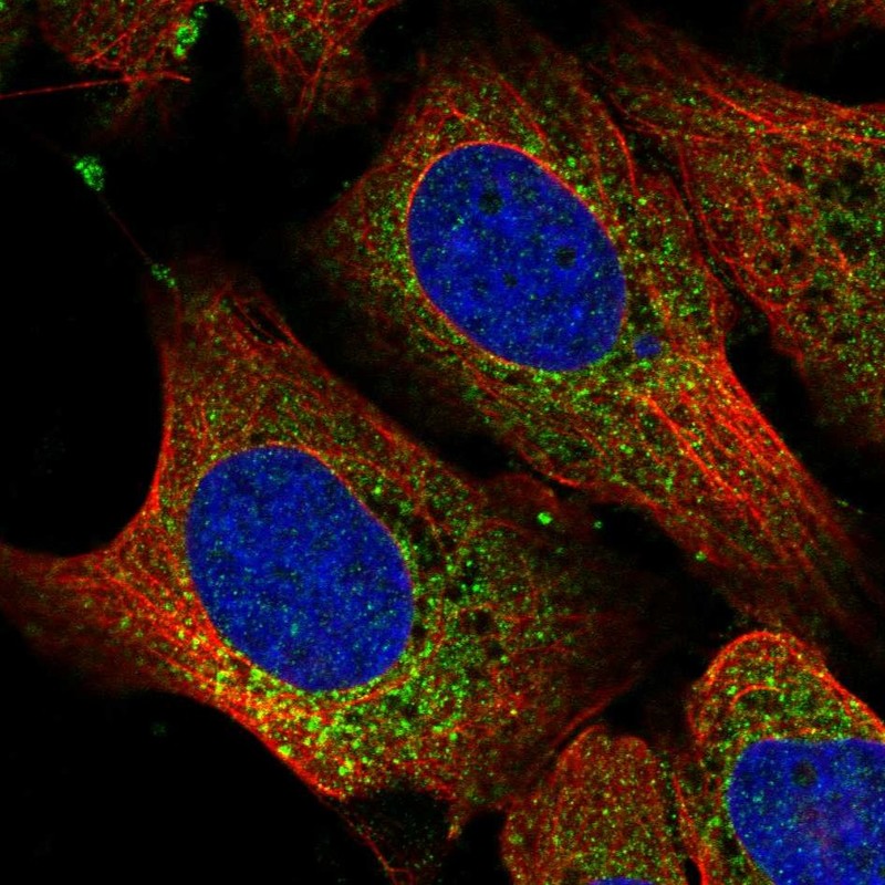 Anti-RPL11 Antibody