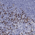 Anti-TRIM29 Antibody