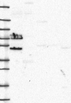 Lane 1: Marker [kDa] 250, 130, 95, 72, 55, 36, 28, 17, 10 | Lane 2: RT4 | Lane 3: U-251 MG | Lane 4: Human Plasma | Lane 5: Liver | Lane 6: Tonsil
