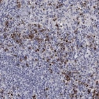 Anti-CHIT1 Antibody