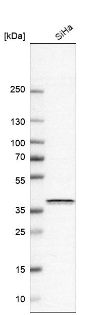Anti-BSG Antibody