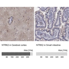 Anti-NTRK2 Antibody