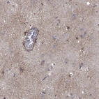 Immunohistochemical staining of human cerebral cortex shows high expression.