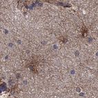Immunohistochemical staining of human hippocampus shows cytoplasmic positivity in glial cells.