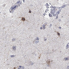 Anti-TMEM169 Antibody