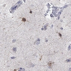 Anti-TMEM169 Antibody