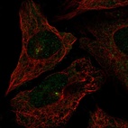 Anti-CEP72 Antibody
