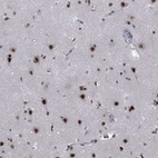 Anti-FYTTD1 Antibody