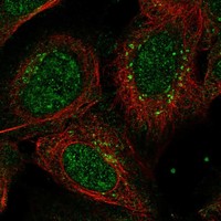 Anti-ANKRD40 Antibody