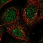 Anti-ANKRD40 Antibody