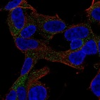 Anti-GARNL3 Antibody