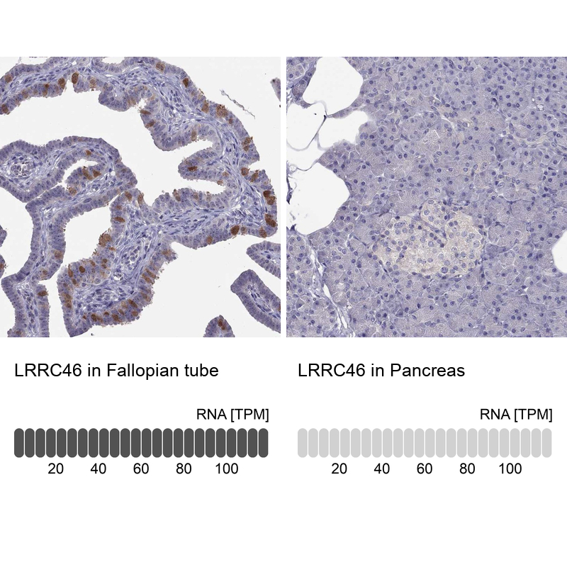 Anti-LRRC46 Antibody