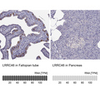 Anti-LRRC46 Antibody